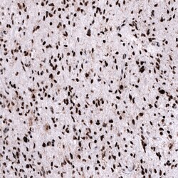 FOXM1 Monoclonal Antibody (CL12131):Antibodies, Monoclonal