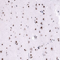 FOXM1 Monoclonal Antibody (CL12131):Antibodies, Monoclonal