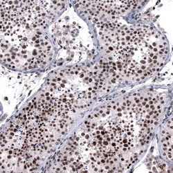 FOXM1 Monoclonal Antibody (CL12131):Antibodies, Monoclonal