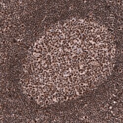 FOXM1 Monoclonal Antibody (CL12131):Antibodies, Monoclonal