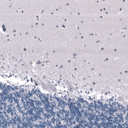 Invitrogen SALL4 Monoclonal Antibody (CL12180) 100 &mu;L; Unconjugated:Antibodies,