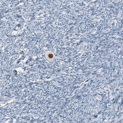 Invitrogen SALL4 Monoclonal Antibody (CL12180) 100 &mu;L; Unconjugated:Antibodies,
