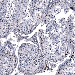 Invitrogen SALL4 Monoclonal Antibody (CL12180) 100 &mu;L; Unconjugated:Antibodies,