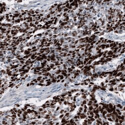 Invitrogen SALL4 Monoclonal Antibody (CL12180) 100 &mu;L; Unconjugated:Antibodies,