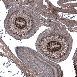 Invitrogen SALL4 Monoclonal Antibody (CL12180) 100 &mu;L; Unconjugated:Antibodies,