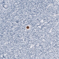 Invitrogen SALL4 Monoclonal Antibody (CL12183) 100 &mu;L; Unconjugated:Antibodies,