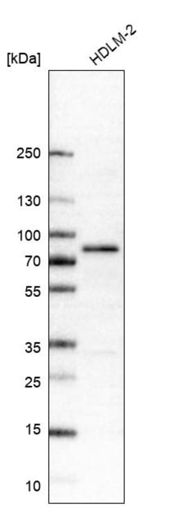 Invitrogen RIP1 Monoclonal Antibody (CL11368) 100 &mu;L | Buy Online | Invitrogen&trade; | Fisher Scientific