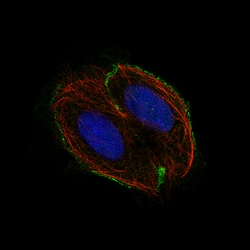 Invitrogen CSF1R Monoclonal Antibody (CL11653) 100 &mu;L; Unconjugated:Antibodies,