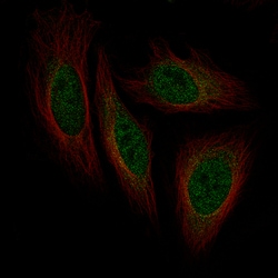 ISL1 Monoclonal Antibody (CL11651):Antibodies, Monoclonal