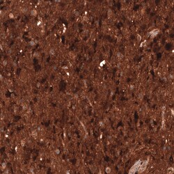 Invitrogen CHI3L1 Monoclonal Antibody (CL12314) 100 &mu;L; Unconjugated:Antibodies,