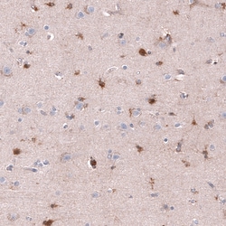 Invitrogen CHI3L1 Monoclonal Antibody (CL12314) 100 &mu;L; Unconjugated:Antibodies,