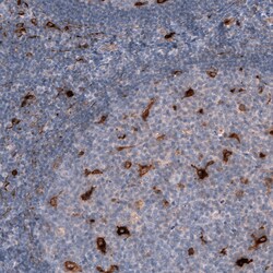 Invitrogen CHI3L1 Monoclonal Antibody (CL12314) 100 &mu;L; Unconjugated:Antibodies,