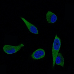 Invitrogen ALDH1A3 Monoclonal Antibody (CL11968) 100 &mu;L; Unconjugated:Antibodies,