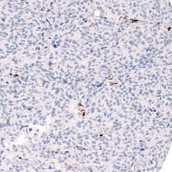 Invitrogen ALDH1A3 Monoclonal Antibody (CL11968) 100 &mu;L; Unconjugated:Antibodies,
