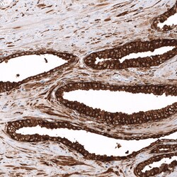 Invitrogen ALDH1A3 Monoclonal Antibody (CL11968) 100 &mu;L; Unconjugated:Antibodies,