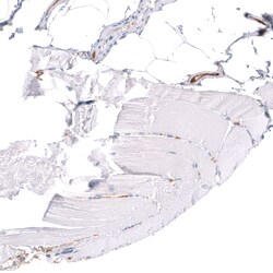 Invitrogen ALDH1A3 Monoclonal Antibody (CL11968) 100 &mu;L; Unconjugated:Antibodies,