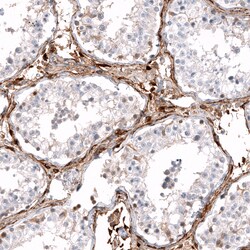 Invitrogen ALDH1A3 Monoclonal Antibody (CL11968) 100 &mu;L; Unconjugated:Antibodies,
