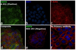 Invitrogen VISTA Recombinant Rabbit Monoclonal Antibody (BLR035F) 100 &mu;L;