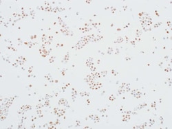 MED12 Recombinant Rabbit Monoclonal Antibody (BLR084G), Invitrogen 10 &mu;L;