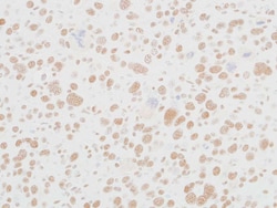 MED12 Recombinant Rabbit Monoclonal Antibody (BLR084G), Invitrogen 10 &mu;L;