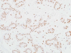 MED12 Recombinant Rabbit Monoclonal Antibody (BLR084G), Invitrogen 10 &mu;L;
