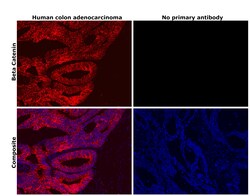 Invitrogen beta Catenin Recombinant Rabbit Monoclonal Antibody (BLR086G)