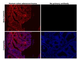 Invitrogen beta Catenin Recombinant Rabbit Monoclonal Antibody (BLR086G)