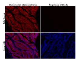 Invitrogen beta Catenin Recombinant Rabbit Monoclonal Antibody (BLR086G)