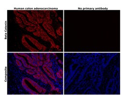 Invitrogen beta Catenin Recombinant Rabbit Monoclonal Antibody (BLR086G)