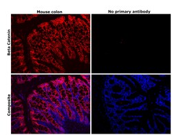 Invitrogen beta Catenin Recombinant Rabbit Monoclonal Antibody (BLR086G)