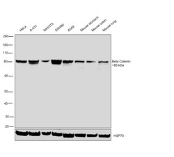 Invitrogen beta Catenin Recombinant Rabbit Monoclonal Antibody (BLR086G)