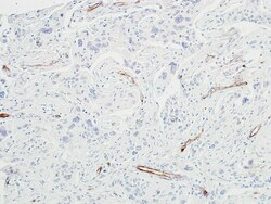 Invitrogen CD144 (VE-cadherin) Recombinant Rabbit Monoclonal Antibody (BLR091G):Antibodies:Primary