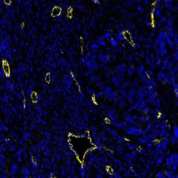 Invitrogen CD144 (VE-cadherin) Recombinant Rabbit Monoclonal Antibody (BLR091G):Antibodies:Primary