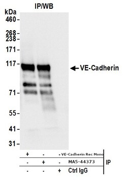 Invitrogen CD144 (VE-cadherin) Recombinant Rabbit Monoclonal Antibody (BLR091G):Antibodies:Primary