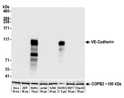 Invitrogen CD144 (VE-cadherin) Recombinant Rabbit Monoclonal Antibody (BLR091G):Antibodies:Primary