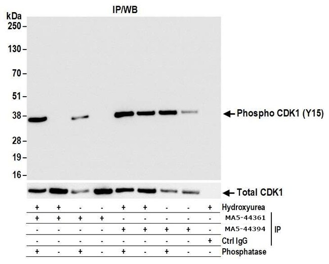 Phospho-Cdk1/Cdk2/Cdk3 (Thr14) (L15) Rabbit mAb