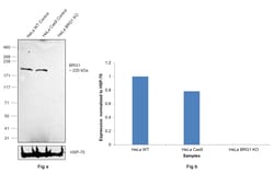 Invitrogen BRG1 Recombinant Rabbit Monoclonal Antibody (BLR106H):Antibodies:Primary