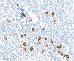 Invitrogen Human IgG4 Recombinant Rabbit Monoclonal Antibody (BLR113H):Antibodies:Primary