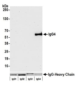 Invitrogen Human IgG4 Recombinant Rabbit Monoclonal Antibody (BLR113H):Antibodies:Primary