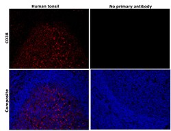 Invitrogen CD38 Recombinant Rabbit Monoclonal Antibody (BLR123H) 100 &mu;L;