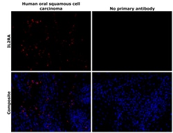 Invitrogen CD25 Recombinant Rabbit Monoclonal Antibody (BLR158J) 100 &mu;L;