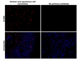 Invitrogen CD25 Recombinant Rabbit Monoclonal Antibody (BLR158J) 100 &mu;L;