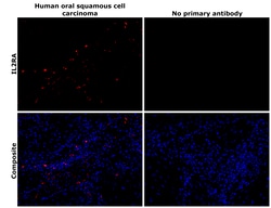 Invitrogen CD25 Recombinant Rabbit Monoclonal Antibody (BLR158J) 100 &mu;L;