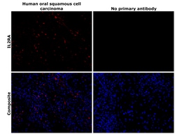Invitrogen CD25 Recombinant Rabbit Monoclonal Antibody (BLR158J) 100 &mu;L;