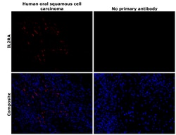 Invitrogen CD25 Recombinant Rabbit Monoclonal Antibody (BLR158J) 100 &mu;L;