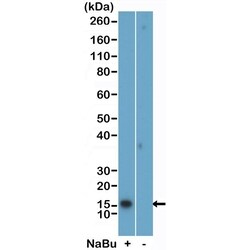 Invitrogen H2BK5ac Recombinant Rabbit Monoclonal Antibody (RM455) 100 &mu;g;