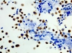 Invitrogen B-Raf (V600E) Recombinant Rabbit Monoclonal Antibody (RM8),
