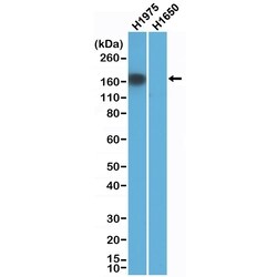 Invitrogen EGFR (L858R Mutant) Recombinant Rabbit Monoclonal Antibody (RM380)