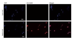 Invitrogen H3.3 G34R oncohistone mutant Recombinant Rabbit Monoclonal Antibody