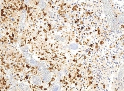 Invitrogen H3.3 G34R oncohistone mutant Recombinant Rabbit Monoclonal Antibody